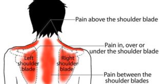 Pain under shoulder blade