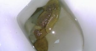 Floating poop