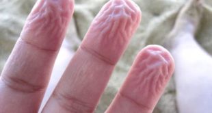 Wrinkled fingertips